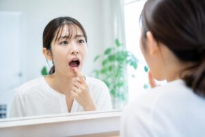 舌苔による口臭のセルフチェック方法は？