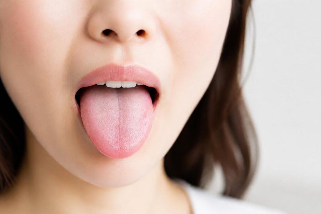 どうして舌が臭いと評判なのか、その原因と対策は？